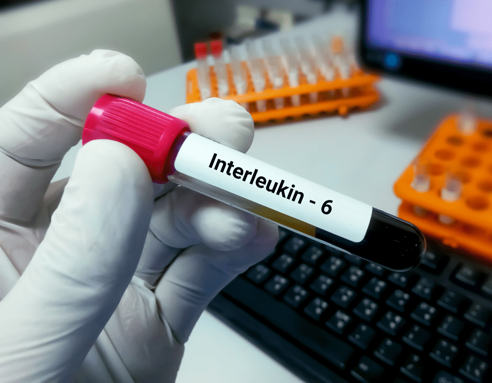 Interleukin-6